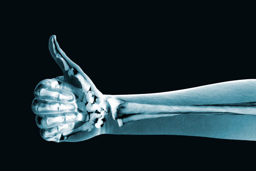 x-ray hand